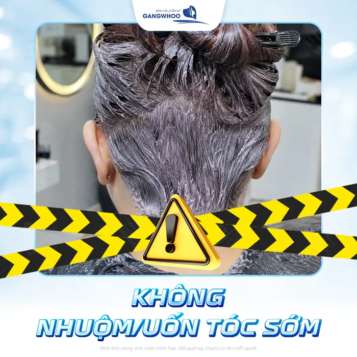 Căng Da Mặt Tóc Bao Lâu Mọc Lại? Bác Sĩ Thẩm Mỹ Giải Đáp