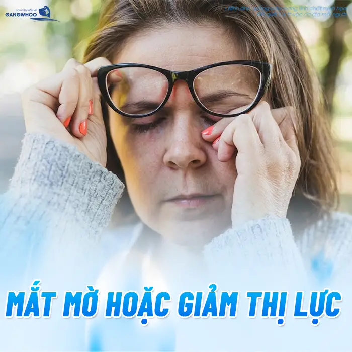 Tại Sao Căng Da Mặt Bị Bầm Mắt? Nguyên Nhân Và Cách Giảm Bầm