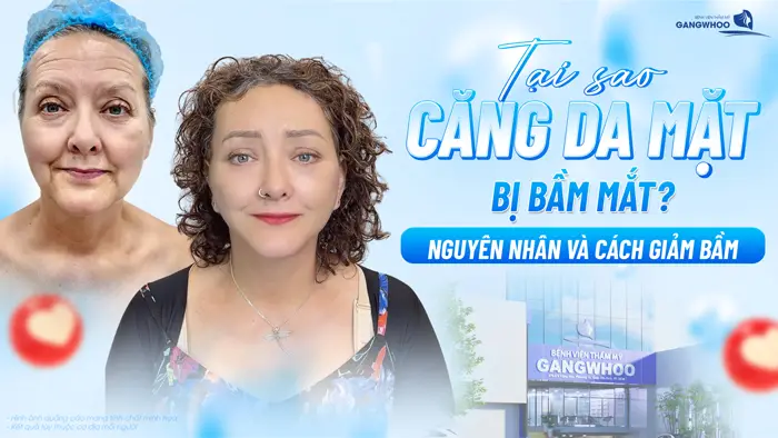 cang da mat bi bam mat