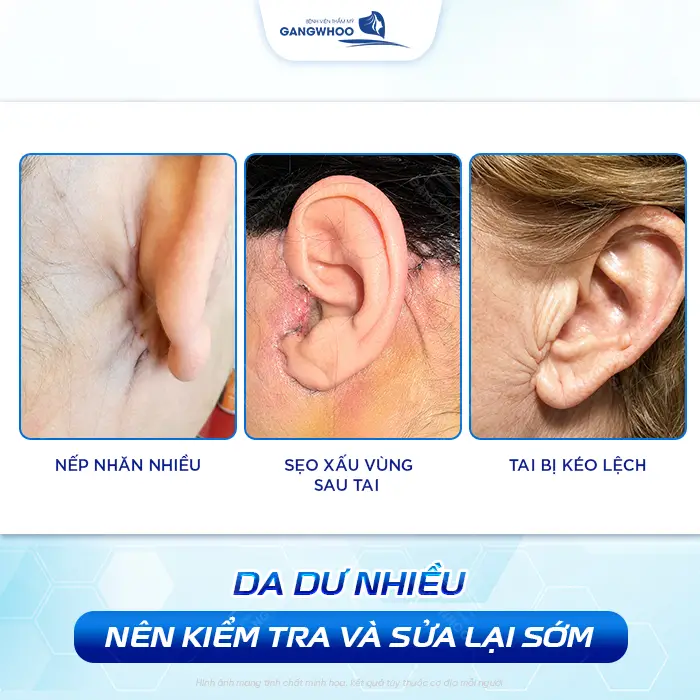 Căng Da Mặt Bị Nhăn Da Sau Tai Có Nguy Hiểm Không? Bác Sĩ Giải Đáp