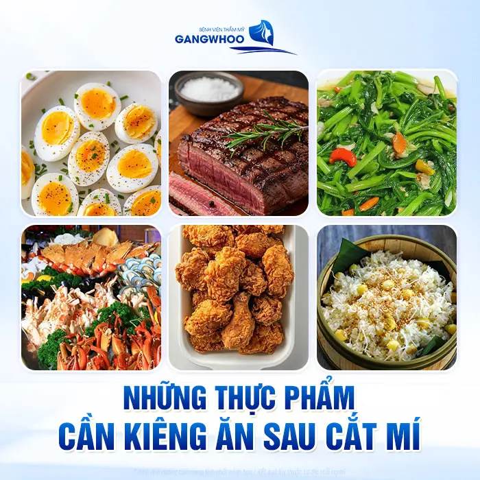 Những thực phẩm cần kiêng ăn sau cắt mí mà bạn nên ghi nhớ để tránh ăn sau vừa can thiệp phẫu thuật 