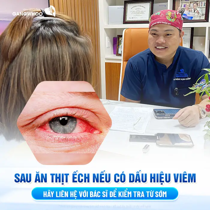 Sau ăn thịt ếch nếu có dấu hiệu viêm hãy liên hệ với bác sĩ để kiểm tra và khắc phục sớm
