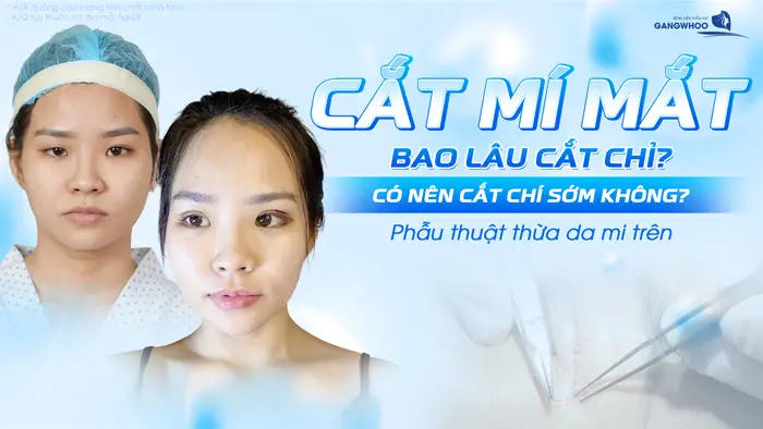 cat mi mat bao lau cat chi