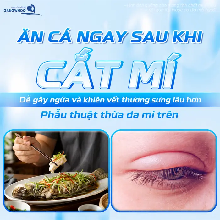 Ăn cá ngay sau khi cắt mí dễ gây ngứa và khiến vết thương sưng lâu hơn