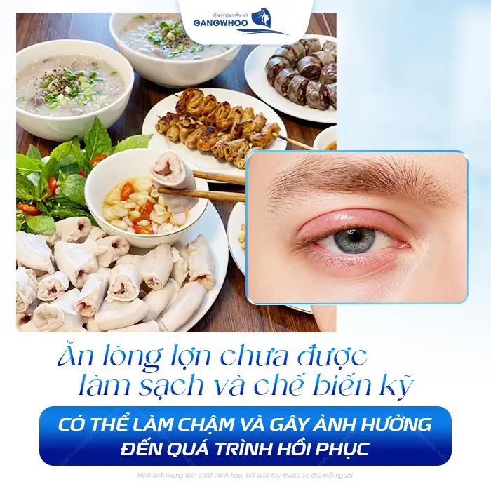Cắt Mí Mắt Có Ăn Được Lòng Lợn Không? Bác Sĩ Giải Đáp Chi Tiết 2 Cắt Mí Mắt Có Ăn Được Lòng Lợn Không? Bác Sĩ Giải Đáp Chi Tiết