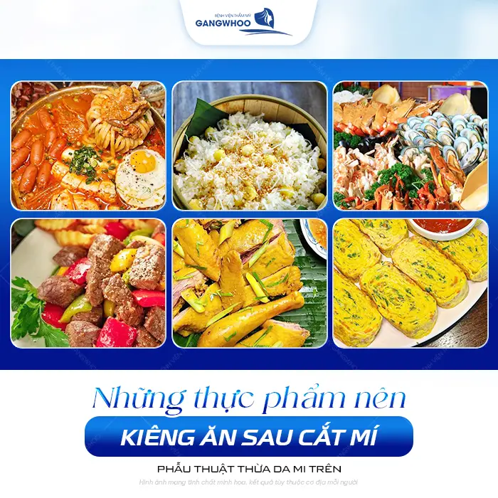 Cắt Mí Mắt Có Ăn Được Lòng Lợn Không? Bác Sĩ Giải Đáp Chi Tiết 4 Cắt Mí Mắt Có Ăn Được Lòng Lợn Không? Bác Sĩ Giải Đáp Chi Tiết