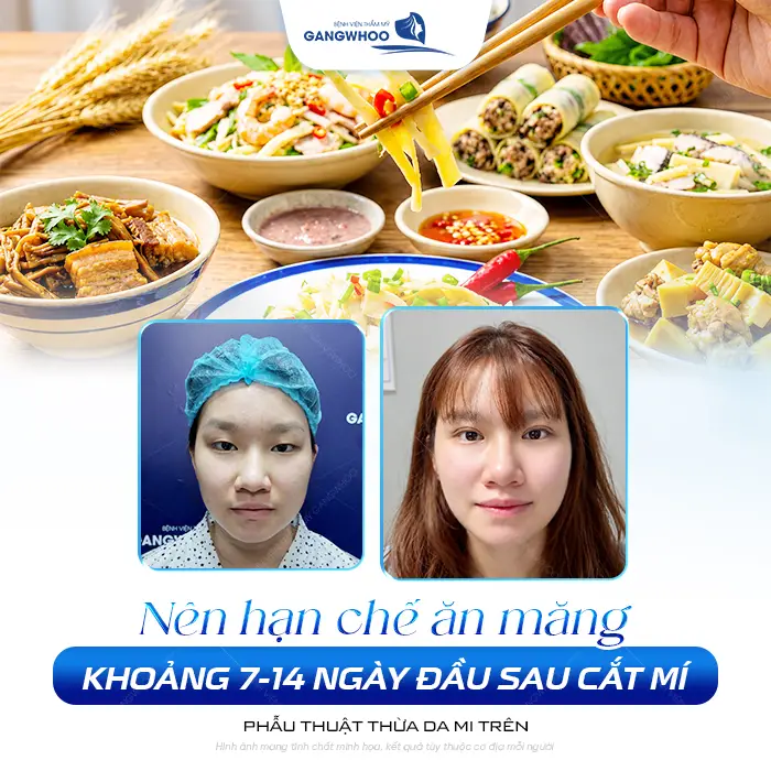 Cắt Mí Mắt Có Ăn Được Măng Không? Phải Kiêng Trong Bao Lâu?