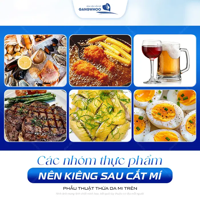 Cắt Mí Mắt Có Ăn Được Măng Không? Phải Kiêng Trong Bao Lâu?