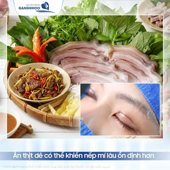 Cắt Mí Mắt Có Ăn Thịt Dê Được Không? Bác Sĩ Giải Đáp Chi Tiết