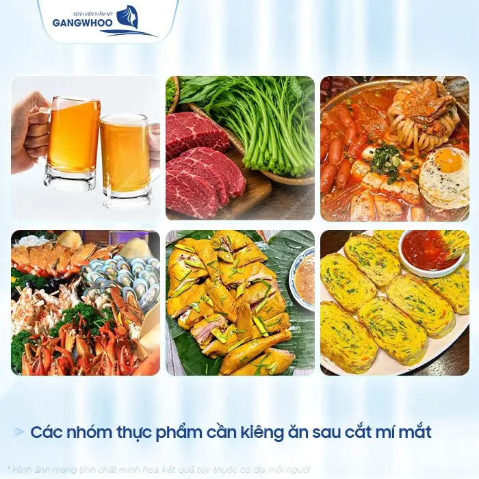 Các nhóm thực phẩm cần kiêng ăn sau cắt mí mắt mà bạn nên đặc biệt chú ý