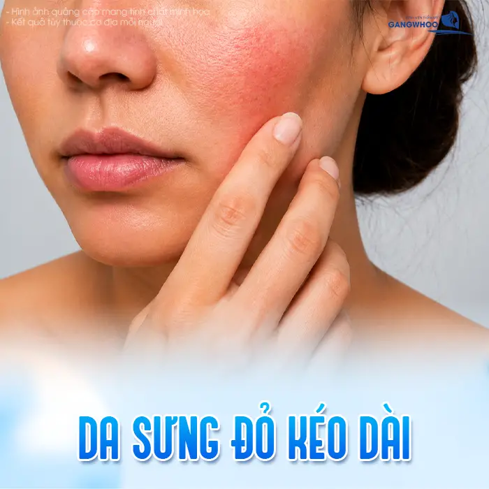 Chỉ Thẩm Mỹ Bị Cộm Ngứa Sau Căng Da Mặt: Nguyên Nhân Và Cách Xử Lý