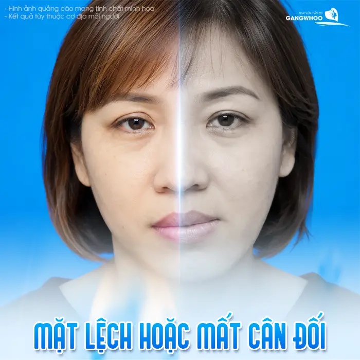 Chỉ Thẩm Mỹ Bị Cộm Ngứa Sau Căng Da Mặt: Nguyên Nhân Và Cách Xử Lý