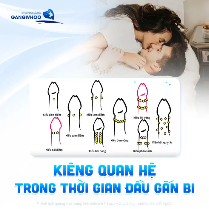 Găm Bi Dương Vật Ở Vị Trí Nào? 7 Vị Trí Gắn Bi Phổ Biến