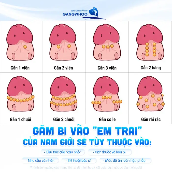 Găm Bi Dương Vật Ở Vị Trí Nào? 7 Vị Trí Gắn Bi Phổ Biến
