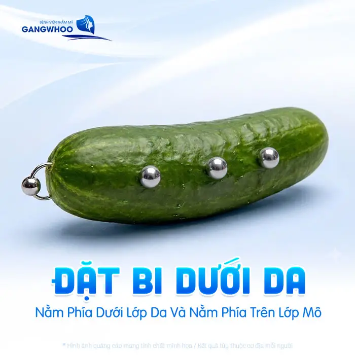 Găm Bi Dương Vật Ở Vị Trí Nào? 7 Vị Trí Gắn Bi Phổ Biến