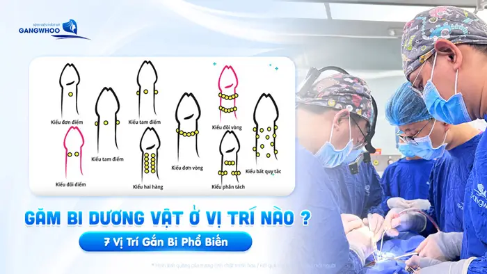 gam bi duong vat o vi tri nao