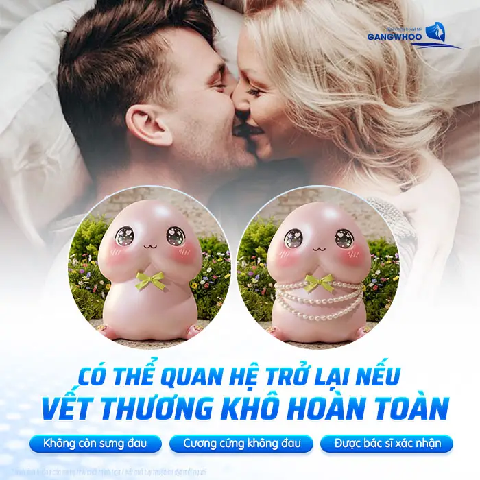 Gắn Bi Bao Lâu Thì Quan Hệ Được? Thời Gian Hồi Phục Và Lưu Ý Quan Trọng