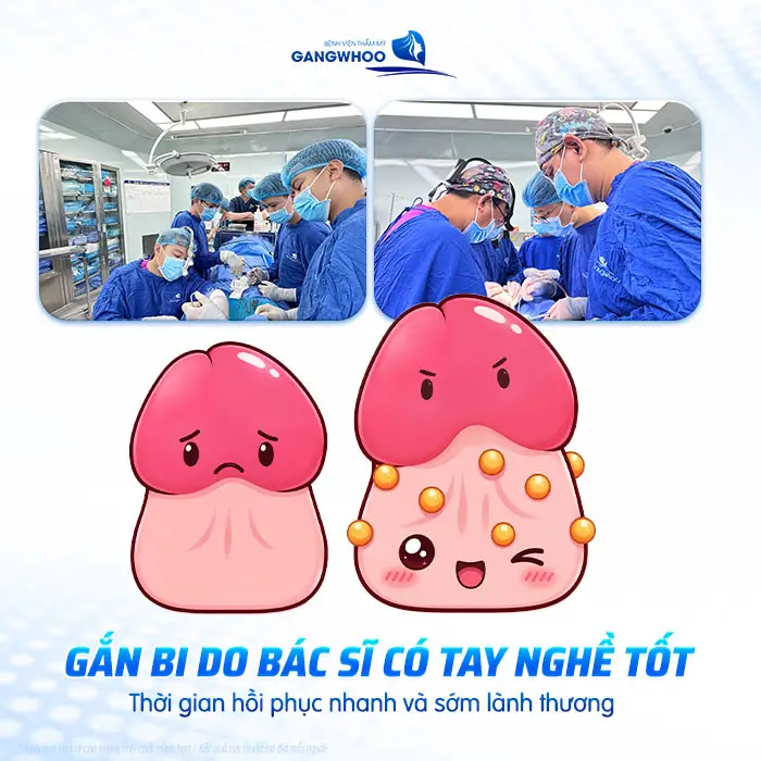 Gắn Bi Bao Lâu Thì Quan Hệ Được? Thời Gian Hồi Phục Và Lưu Ý Quan Trọng