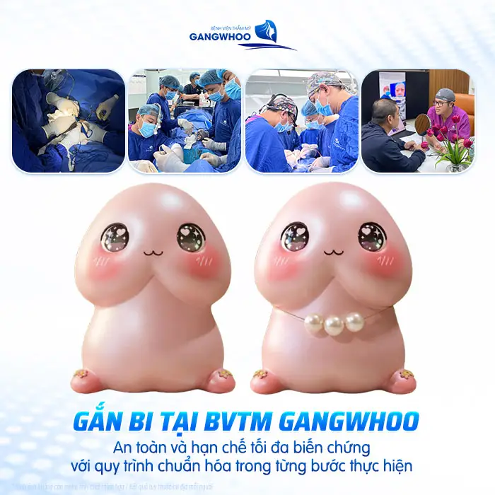 Gắn Bi Bao Lâu Thì Quan Hệ Được? Thời Gian Hồi Phục Và Lưu Ý Quan Trọng