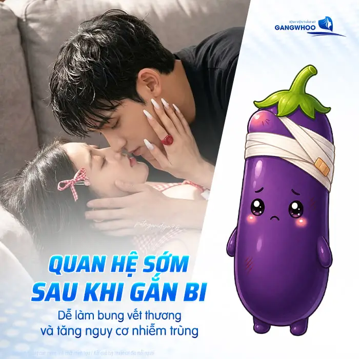 Gắn Bi Bao Lâu Thì Quan Hệ Được? Thời Gian Hồi Phục Và Lưu Ý Quan Trọng