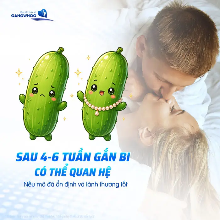 Gắn Bi Bao Lâu Thì Quan Hệ Được? Thời Gian Hồi Phục Và Lưu Ý Quan Trọng