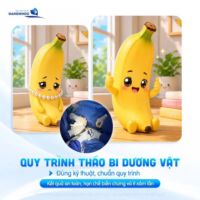 Gắn Bi Có Tháo Ra Được Không? Bác Sĩ Nam Khoa Giải Đáp