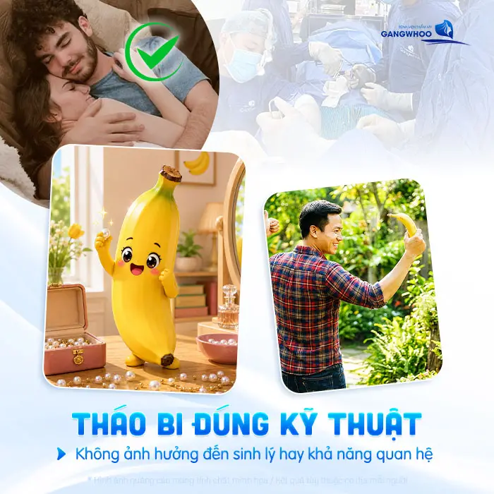 Gắn Bi Có Tháo Ra Được Không? Bác Sĩ Nam Khoa Giải Đáp