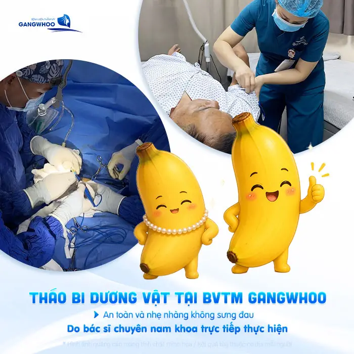 Gắn Bi Có Tháo Ra Được Không? Bác Sĩ Nam Khoa Giải Đáp