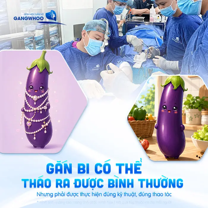Gắn Bi Có Tháo Ra Được Không? Bác Sĩ Nam Khoa Giải Đáp