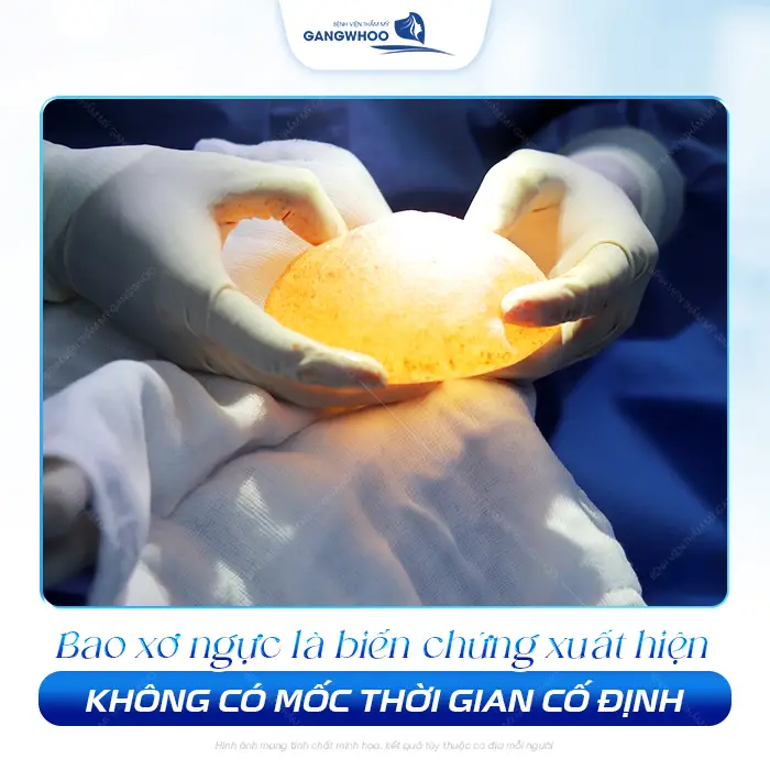 Nâng Ngực Bao Lâu Thì Bị Bao Xơ? Dấu Hiệu Và Cách Phòng Tránh