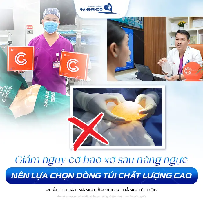 Nâng Ngực Bao Lâu Thì Bị Bao Xơ? Dấu Hiệu Và Cách Phòng Tránh