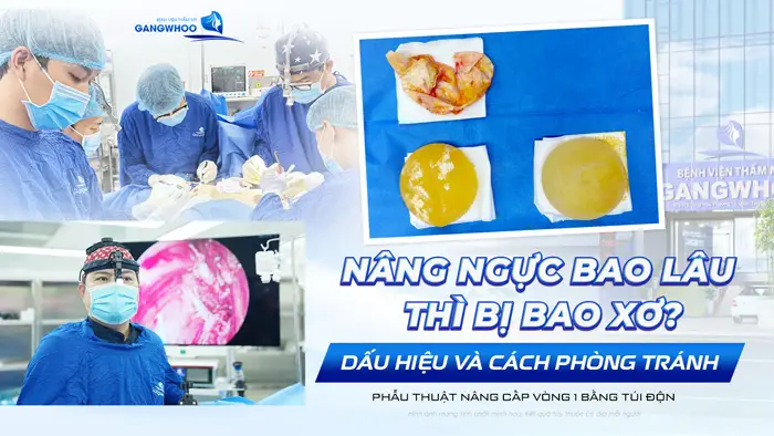 nang nguc bao lau thi bi bao
