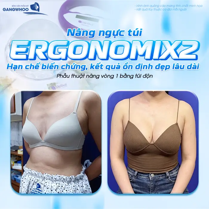 nang nguc tui ergonomix2 11