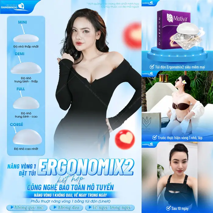 Nâng vòng 1 đặt túi Ergonomix2 kết hợp công nghệ bảo toàn mô tuyến cho vòng 1 an toàn, nhẹ nhàng và không sưng đau