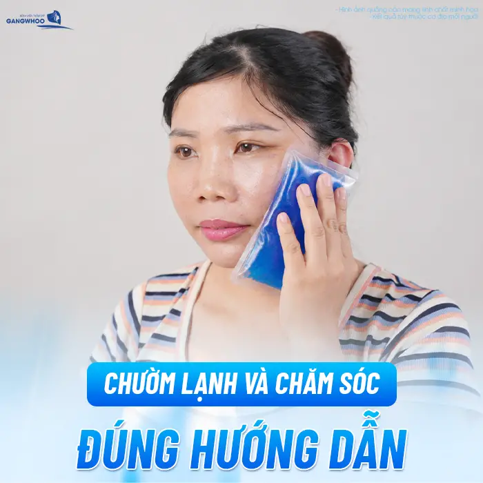 Sau Căng Da Mặt Mặt Lệch Có Sao Không? Nguyên Nhân Và Cách Xử Lý