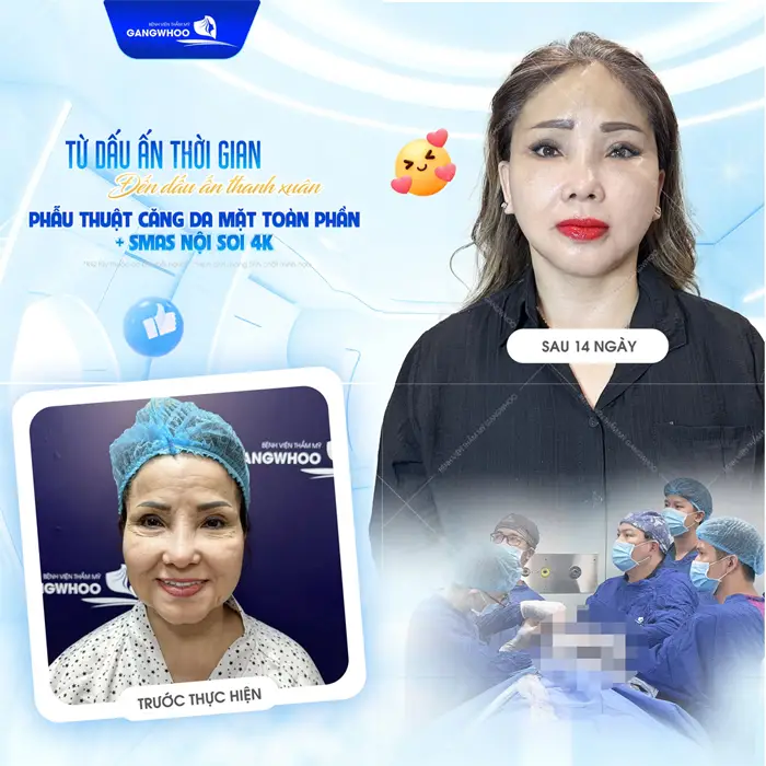 Căng Da Mặt Tóc Bao Lâu Mọc Lại? Bác Sĩ Thẩm Mỹ Giải Đáp