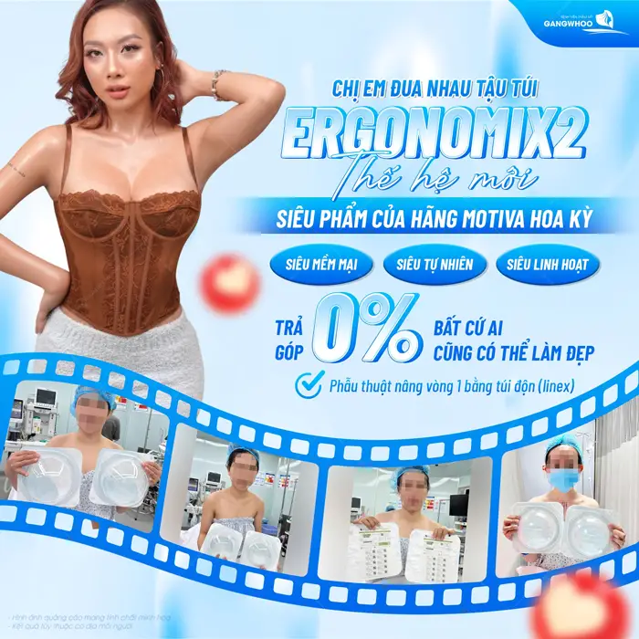 Chị em đua nhau tậu túi Ergonomix2 thế hệ mới siêu phẩm đến từ hãng Motiva Hoa Kỳ mềm mại hơn, tự nhiên hơn 