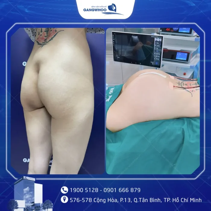 2 2 1 e1782269816536