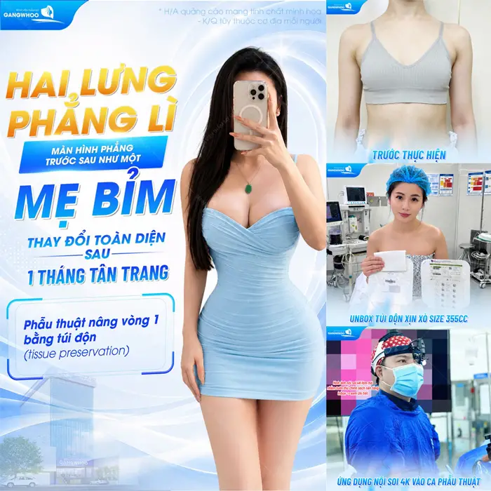 Breast augmentation with Tissue Preservation implants transforms a mother's figure after one month with a naturally enhanced bust