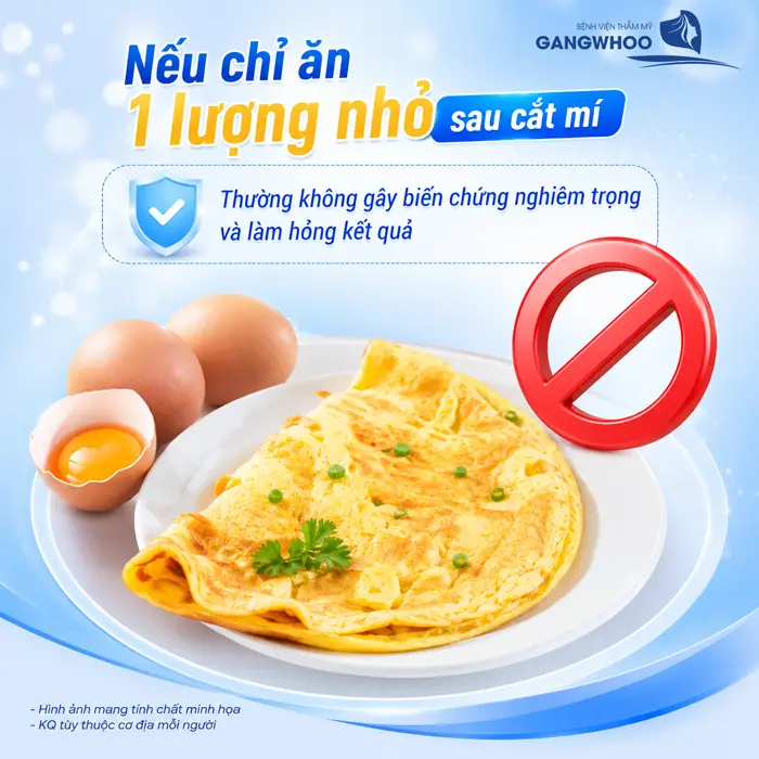Cắt Mí Mắt Ăn Trứng Được Không? Bác Sĩ Giải Đáp Từ Góc Nhìn Chuyên Môn 4 Cắt Mí Mắt Ăn Trứng Được Không? Bác Sĩ Giải Đáp Từ Góc Nhìn Chuyên Môn