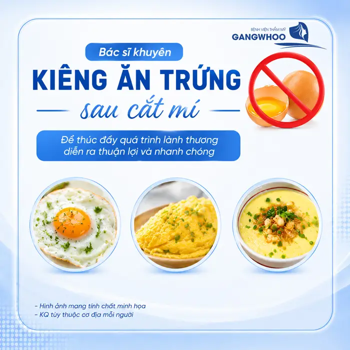 Cắt Mí Mắt Ăn Trứng Được Không? Bác Sĩ Giải Đáp Từ Góc Nhìn Chuyên Môn 1 Cắt Mí Mắt Ăn Trứng Được Không? Bác Sĩ Giải Đáp Từ Góc Nhìn Chuyên Môn