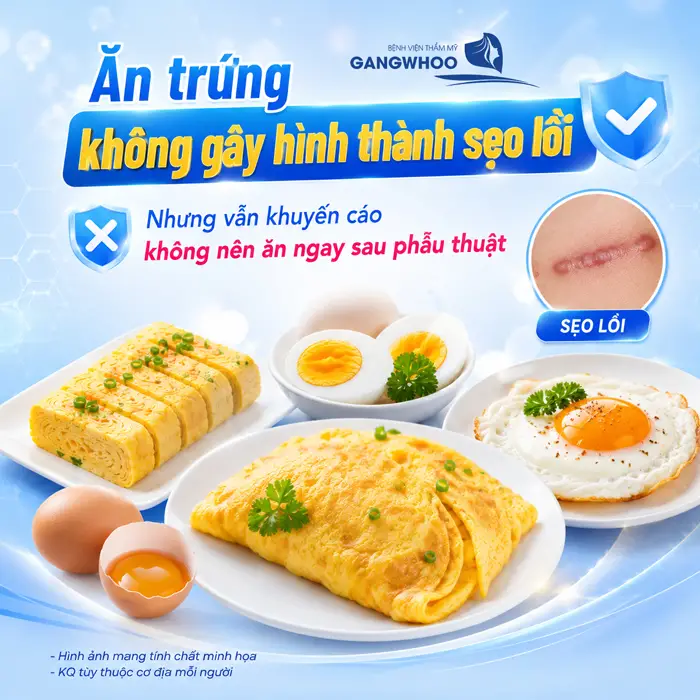 Cắt Mí Mắt Ăn Trứng Được Không? Bác Sĩ Giải Đáp Từ Góc Nhìn Chuyên Môn 2 Cắt Mí Mắt Ăn Trứng Được Không? Bác Sĩ Giải Đáp Từ Góc Nhìn Chuyên Môn