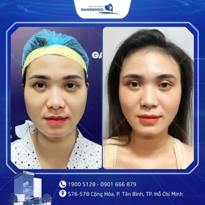 don thai duong 2