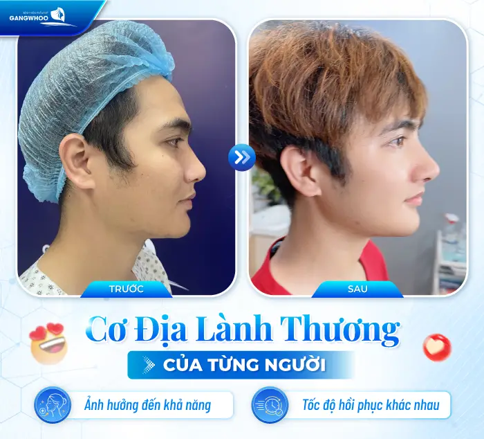 Gọt Hàm Có Để Lại Sẹo Không? Trường Hợp Có Nguy Cơ Để Lại Sẹo