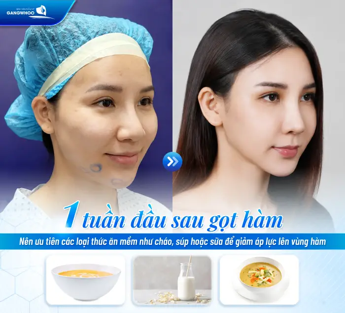 Gọt Hàm Có Để Lại Sẹo Không? Trường Hợp Có Nguy Cơ Để Lại Sẹo