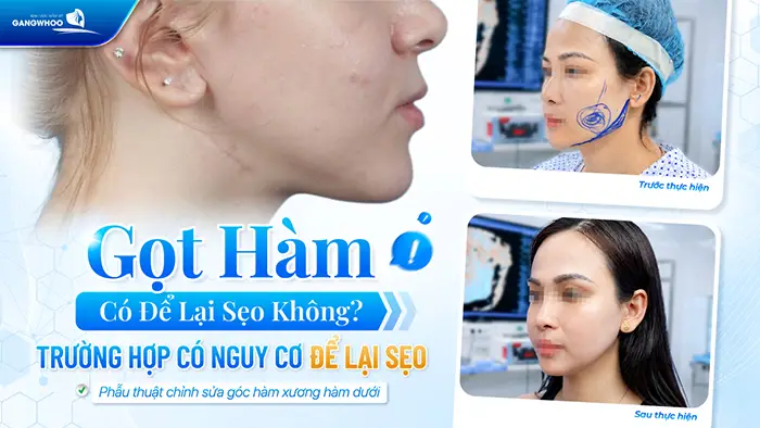 got ham co de lai seo khong