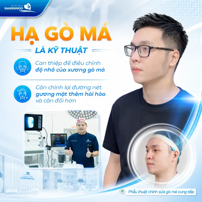 Hạ Gò Má Có Được Vĩnh Viễn Không? Giải Đáp Từ Góc Độ Chuyên Môn 1 Hạ Gò Má Có Được Vĩnh Viễn Không? Giải Đáp Từ Góc Độ Chuyên Môn