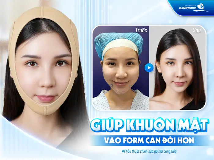 Hạ Gò Má Đeo Đai Định Hình Bao Lâu? Hướng Dẫn Chăm Sóc Đúng Cách