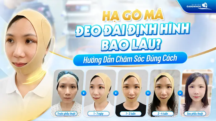 ha go ma deo dai dinh hinh bao lau