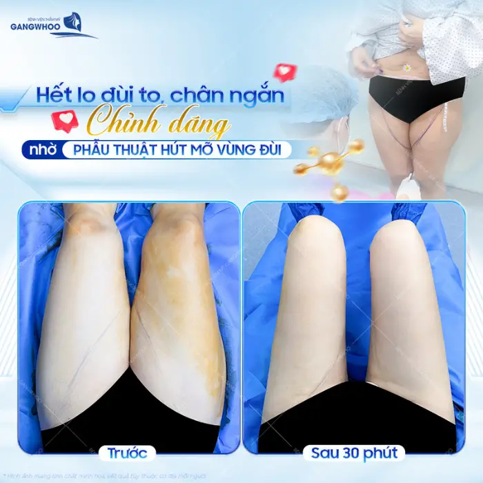 hu mo dui 3